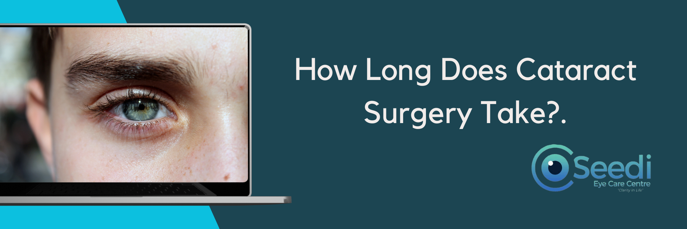 How Long Does Cataract Surgery Take.